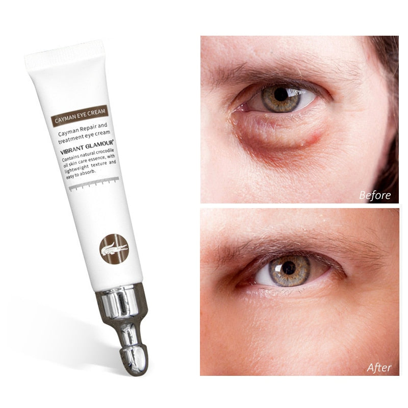 Peptide Collagen Eye Cream Anti Wrinkle Remove Eye Bags Anti Dark Circles Eye Care Essence Against Puffiness Sooth Brighten Skin