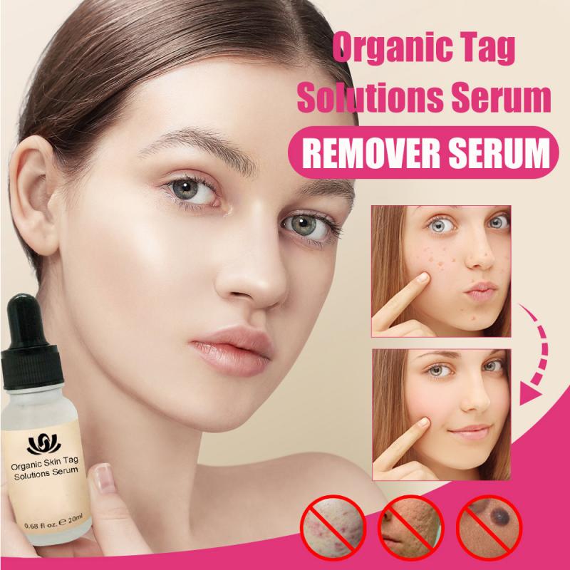Organic Tags Solutions Serum 30g No Trace Painle Skin Tag Remover Serum Mole Removal Cream Painless Face Wart Mole Freckle TSLM1