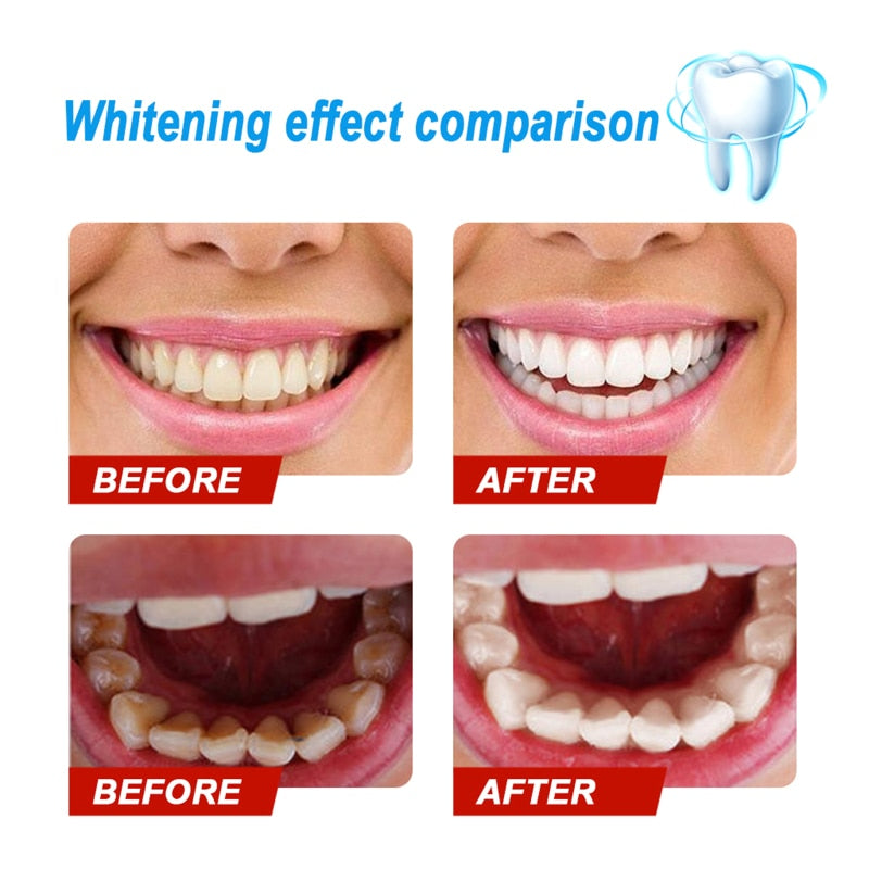 Eelhoe Teeth Whitening Powder Oral Hygiene Whiten Teeth Remove Plaque Stains Fresh Breath Oral Hygiene Teeth Care Tools TSLM1