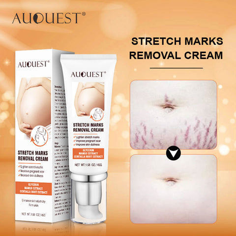 AUQUEST Stretch Marks Removal Maternity Scar Acne Remover for Pregnant Women Anti-Aging Skin Firming Cream Body Care 45g
