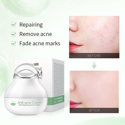 8g Herb Repairing Acne Cream Natural Plant Treatment Anti-Acne Moisturizing Oil Control shrink pores Fade Acne Spots Skin Care