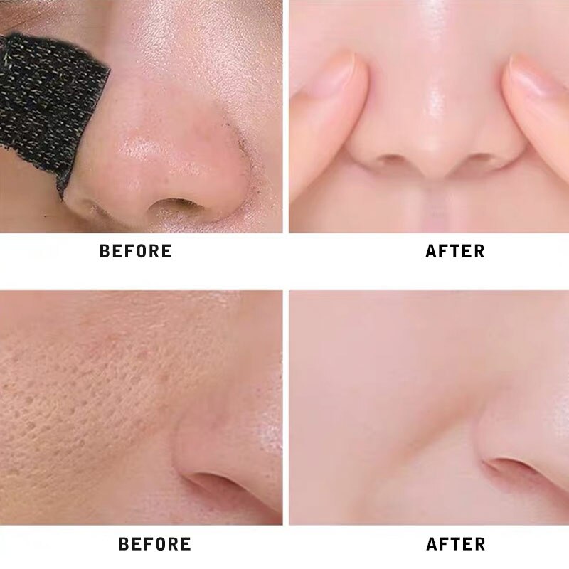 3 Steps Kit Blackhead Remover Shrink Pores Nasal Paste Deep Cleaning Nose Masks Facial T Area Care Moisturizing Beauty Skin Care
