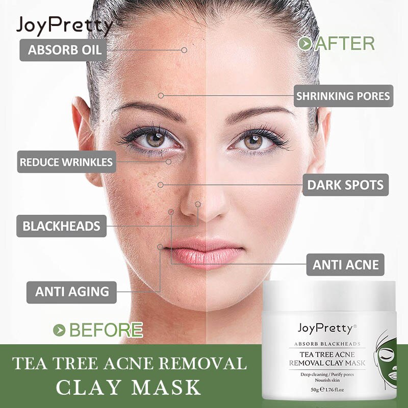 Tea Tree Clay Mask Removal Acne Blackheads Facial Mask Whitening Oil Control Deep Cleaning Beauty Mask Skin Face Care