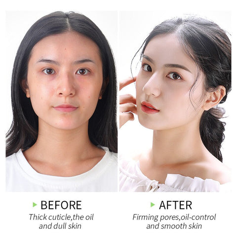 LAIKOU Matcha Exfoliating Exfoliate Peeling Gel Facial Scrub Moisturise Whitening Nourishing Repair Scrubs Face Cream Skin Care