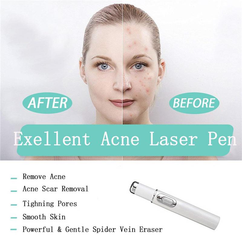 Christmas gift Hot Heath Blue Light Therapy Varicose Veins Treatment Laser Pen Soft Scar Wrinkle Removal Treatment Acne Laser Pen Massage Relax