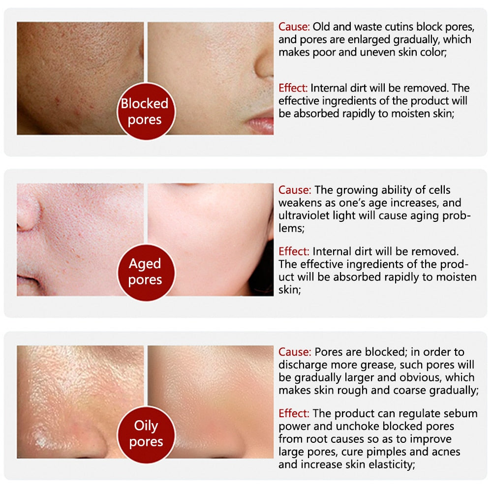 LANBENA Pore Shrink Serum Face Pores Treatment Essence Hyaluronic Acid Moisturizing Dryness Repair Bioaqua Facial Skin Care 15ML