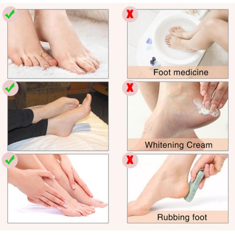 1Pair Foot Peeling Mask Exfoliating Pedicure Sock Remove Dead Skin Foot Peeling Moisturizing Nourishing Legs Whitening Foot Care