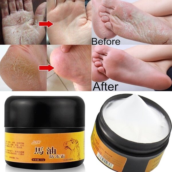 1pc Horse Oil Feet Cream Care Beriberi Cream for Athlete's Foot Feet Itch Blisters Anti-chapping Peeling Beriberi Bad Feet Ointm