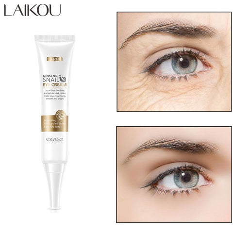 LAIKOU Snail Eye Cream Remove Wrinkles Anti-Aging Get Rid Dark Puffy Eye Bag Circles Niacinamide Whitening Nourish Eye Skin Care