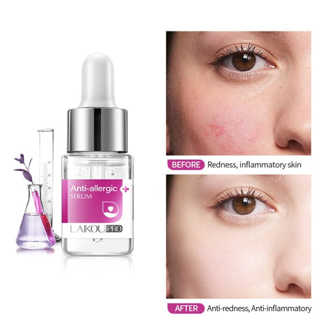 Anti-allergic Serum Chinese Herbal Anti-sensitive Anti-redness Facial Essence Shrink Pores  Soothe Skin Treat Acne Face Serum