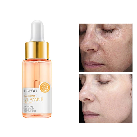30ml Vitamin C Facial Whitening Serum Skin Care Lotion Antioxidant Brighten Skin Remove Spot Reduce Wrinkles Face Essence 17ml