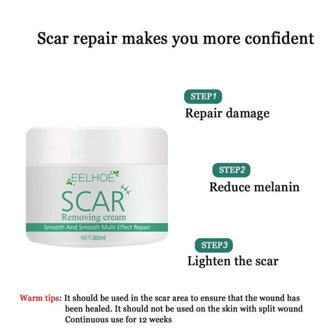 Smooth Skin Acne Scar Stretch Mark Remover Repair Cream Acne Spot Scar Cream Scar Removal Women Effective Face Care Product
