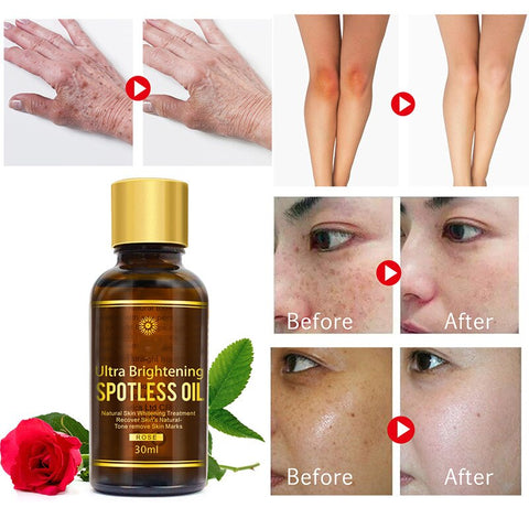 Ultra Brightening Spotless Oil Dark Spots Remove Ance Burn Strentch Against Scar Removal Whitening Skin Care Essence