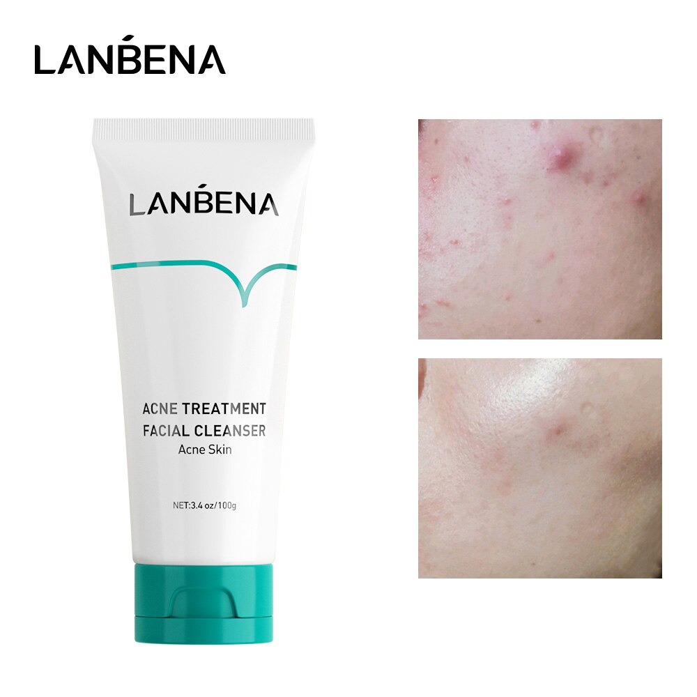 LANBENA Face Cleanser VC Whitening Cleansing Facial Foam Acne Treatment Repair Ectoin 24K Gold Peptide Anti Aging Skin Care 100g
