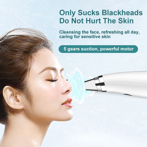 Electric Microdermabrasion Vacuum blackhead Remover Acne Pore cleaner Pimple Remover  facial Beautyblack dot vacuum cleaner