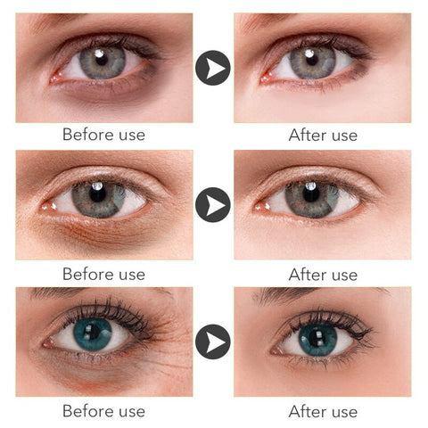 Nicotinamide Seaweed Eye Mask Natural Whitening Moisturizing Gel Eye Patches Remove Dark Circles Anti Age Bag Eye Wrinkles 60pcs