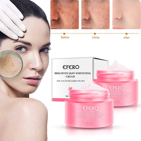 Beyprern Skin Whitening Cream Freckle Cream Remove Acne Dark Pigment Spots Melanin Pimple Cream Face Cream Face Serum Skin Care