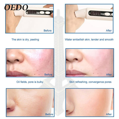 OEDO Rose Peptide Nourish Clear Toner Skin Care Whitening Moisturizing Acne Treatment Black Head Anti Wrinkle Ageless Beauty