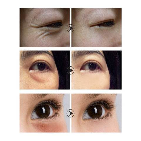 LANBENA Whitening Lady Eye Cream Remove Dark Circle Anti Aging Repair Ageless Lifting Firming Fade Puffy Eyes Elastin Skin Care
