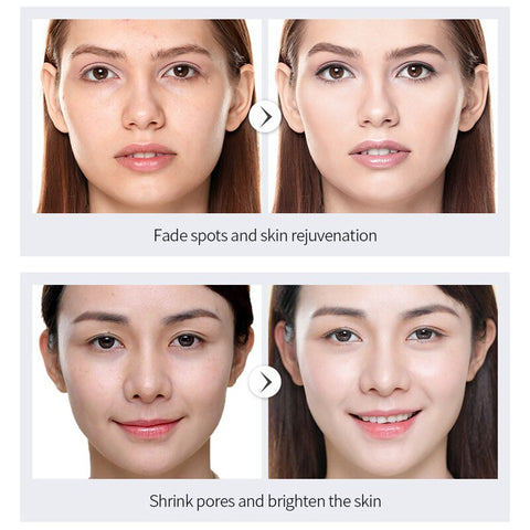 Beyprern 12 Ml Rich Niacinamide Whitening Freckle Facial Serum Shrink Pores Deep Moisturizing Brightening Skin Tone Face Care