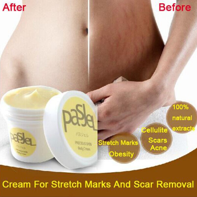 Pasjel new Arrival Effective stretch marks scar removal Cream slack line firming & lifting skin stretch mark repair cream