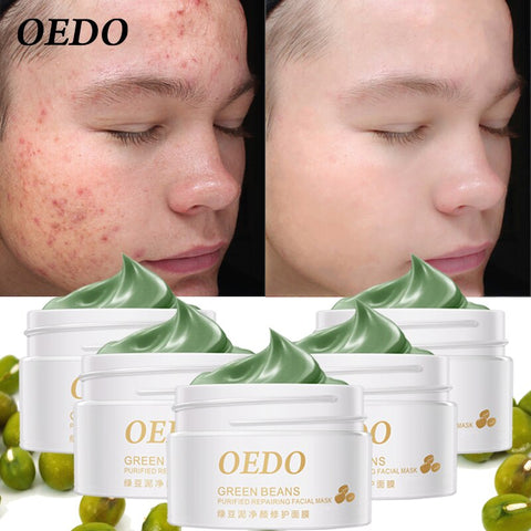 5PCS Acne Blackhead Treatment Mask Mung Bean Mud Peeling Remover Facial Cream Effective Whitening Hydrating Skin Care Cleaning