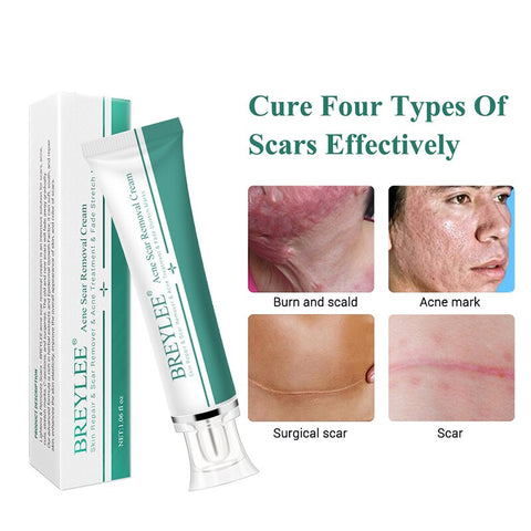 1Pcs Repair Scar Cream 30g Antibacterial Ointment Stretch Marks Removal Burns Fade Acne Cream Scar Repairing Gel Skin Care