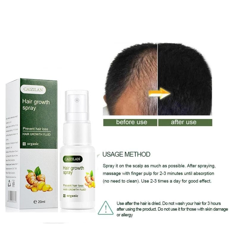 20ML Anti Hair Loss Products Hair Growth Spray Essential Oil Liquid for Men Women Growth Essence Serum Hair Care Repair Growing