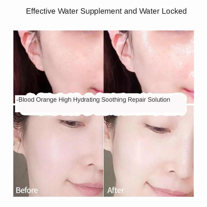 Beyprern 100Ml Blood Orange VC Essence Facial Serum Liquid Rich Vitamin C Whitening Freckle Moisture Face Care Beauty Antioxidation
