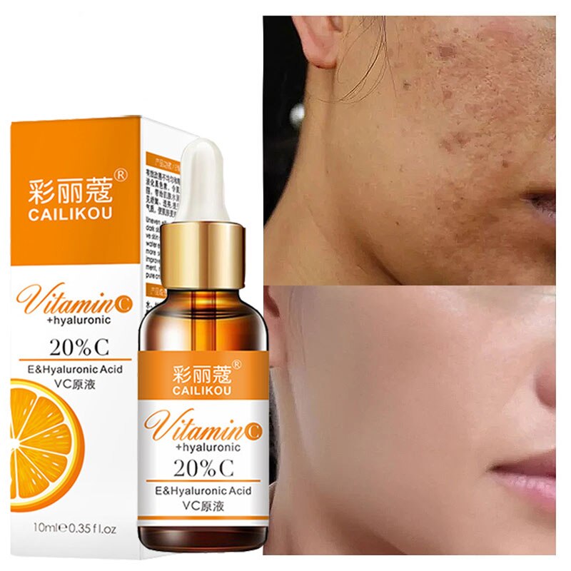 Vitamin C Whitening Face Serum Lighten Spots Brightening Facial Skin Essence Fade Dark Spots Remove Freckle Speckle Care