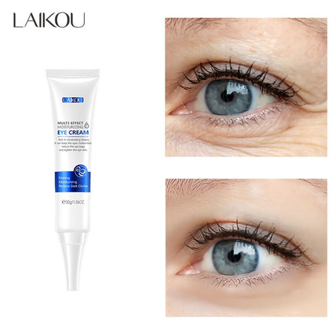 LAIKOU Hyaluronic Acid Eye Cream Dark Circles Anti-Age Anti Wrinkle Multi-effect Moisturizing Tighten Fade Fine Lines Skin Care