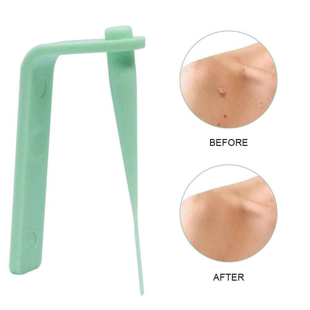 Skin Tag Kill Skin Mole Wart Remover Skin Tag Removal Kit With Cleansing Swabs Adult Mole Wart Face Care Skin Tags Tool