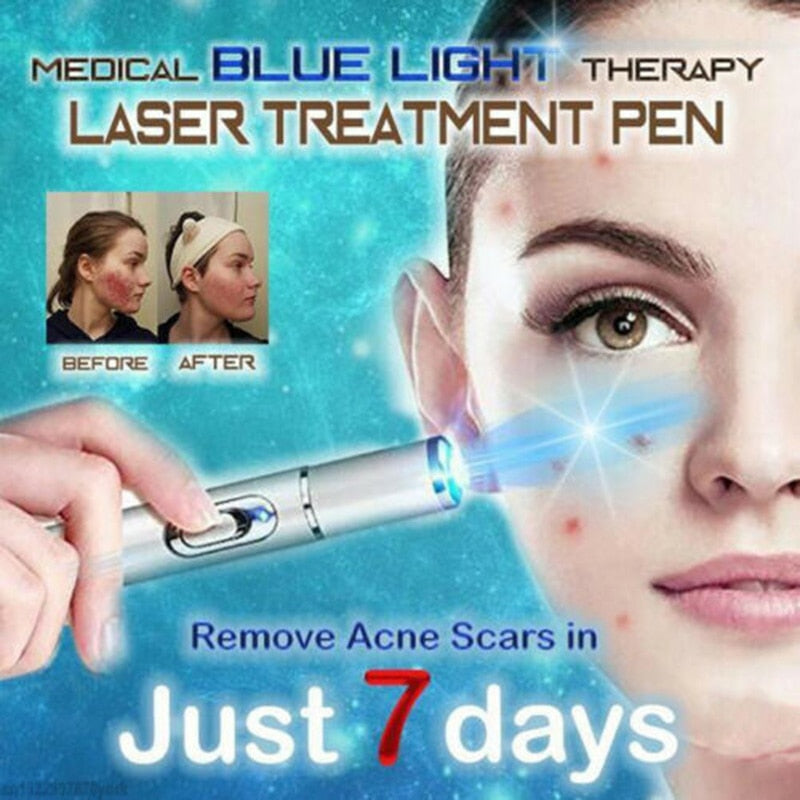 Christmas gift KD-7910 Acne Laser Pen Portable Wrinkle Removal Machine Durable Soft Scar Remover Device Blue Light Therapy Pen Massage Relax