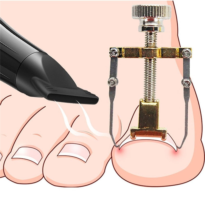 Christmas gift Ingrown Toenail Corrector Pedicure Toenail Fixer Foot Nail Care Orthotic Stainless Steel Treatment Onyxis Bunion Correction Tool