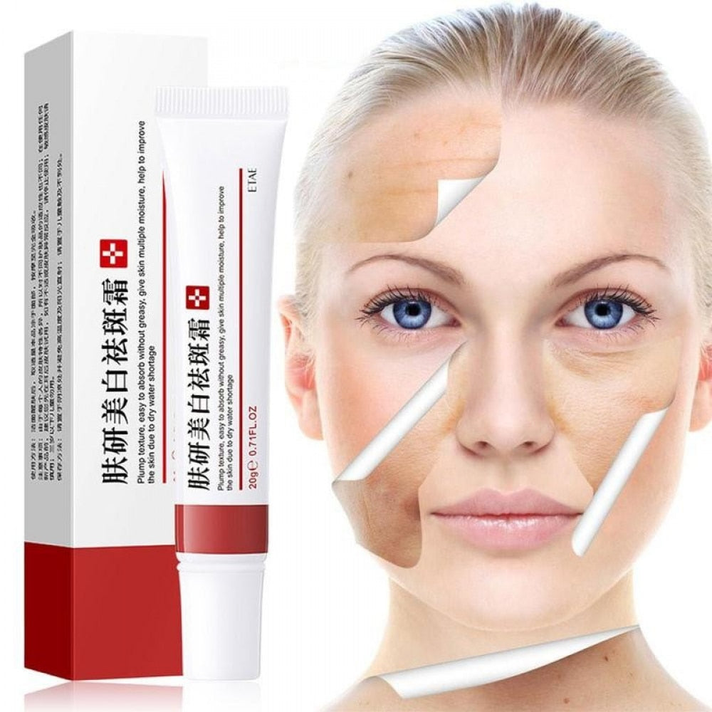 Beyprern Effective Freckle Cream Remove Dark Spots Witening Cream Fade Acne Scars Melanin Pigmentation Melasma Anti-Aging Skin Lightening