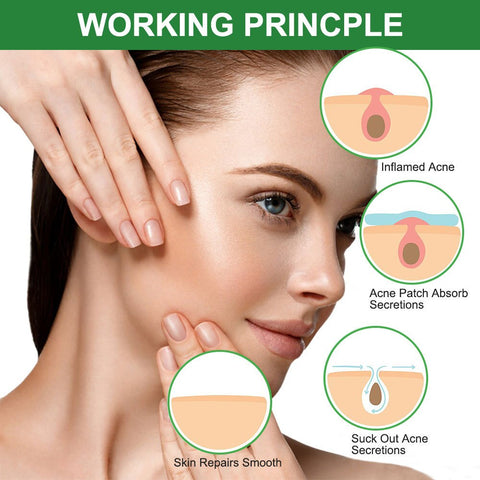 Acne Pimple Patch Facial Treatment  Invisible Acne Repair Removal Blackhead Hydrocolloid Stickers Skin Care Tools