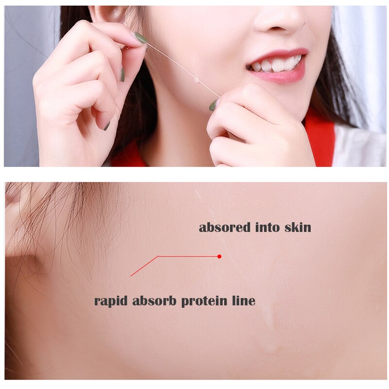 Face Filler Absorbable Collagen Protein Thread Face Lift Plump Silk Fibroin Line Carving Anti Aging Facial Lift Tightening Skin
