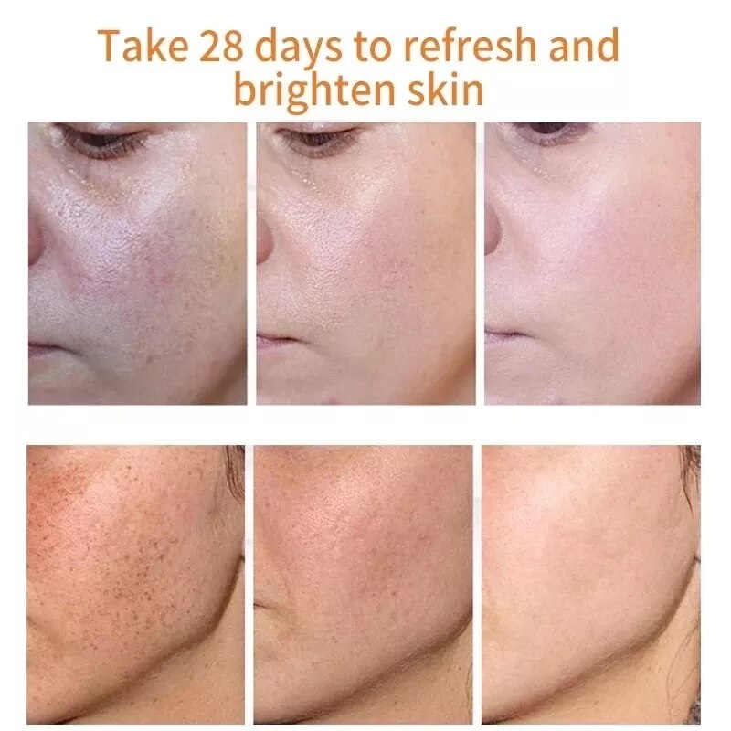 Beyprern Remove Serum Whitening Freckle Fade Melasma Acne Spot Bleach Skin Care Anti-Aging Moisturizing Brighten Beauty Product