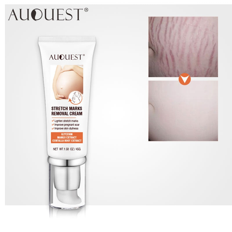 AUQUEST Stretch Marks Removal Maternity Scar Acne Remover for Pregnant Women Anti-Aging Skin Firming Cream Body Care 45g