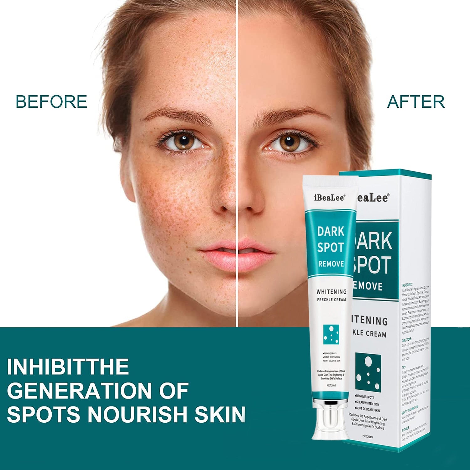 iBeaLee Whitening Freckle Cream Remove Melasma Cream Remove Freckles Remove Dark Spots Melasma Remover Brighten Skin Anti-Aging